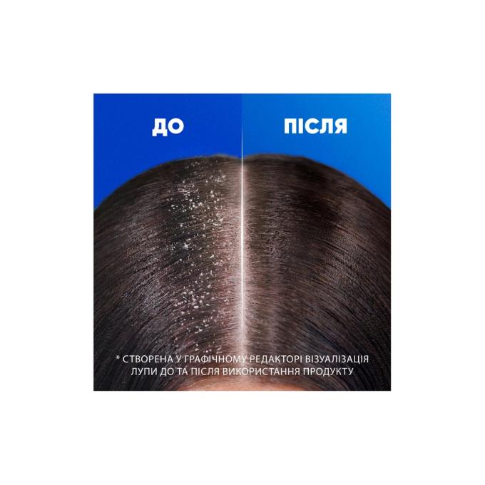 Head & Shoulders 5011321336124