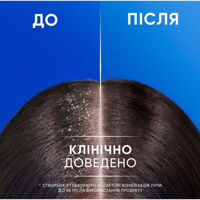 Head & Shoulders 8700216304689