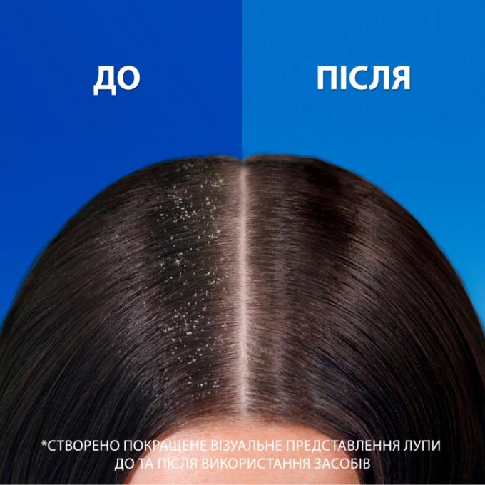 Head & Shoulders 8700216156936
