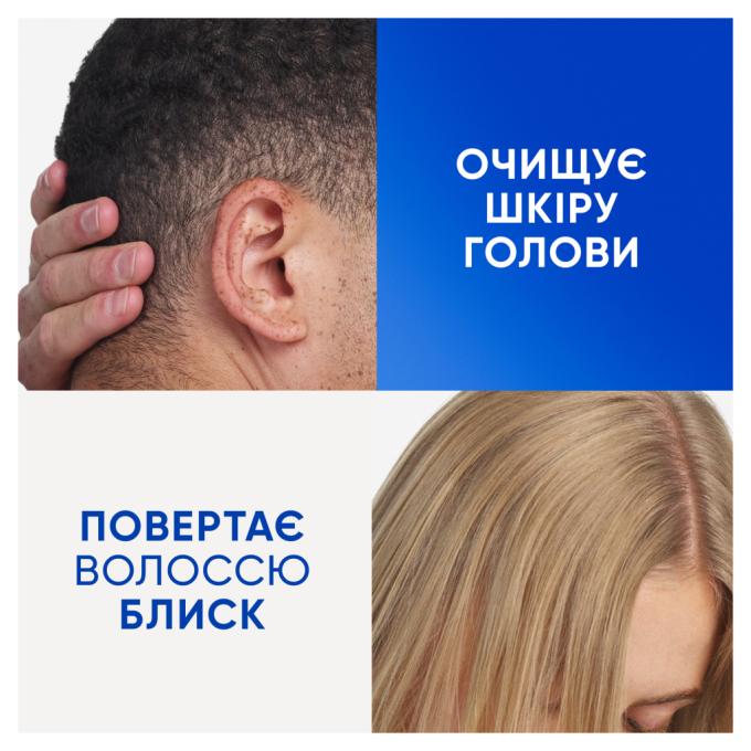 Head & Shoulders 8700216658461