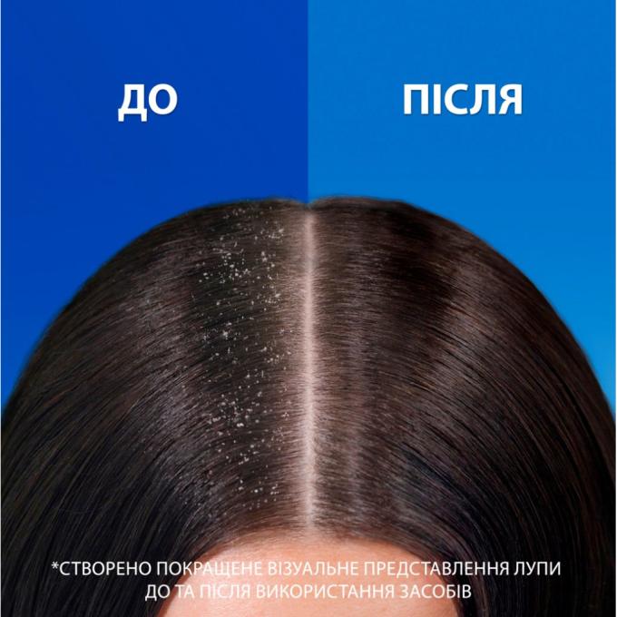 Head & Shoulders 8700216156844