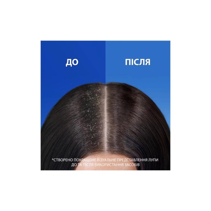 Head & Shoulders 8700216156172