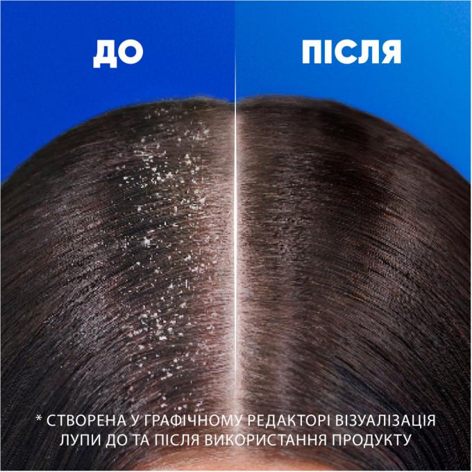 Head & Shoulders 8700216304948