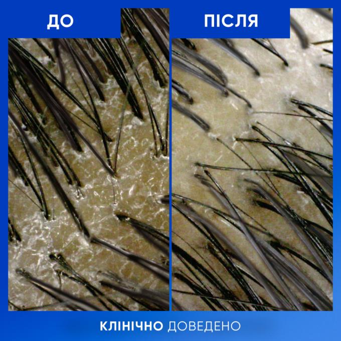 Head & Shoulders 8700216658461