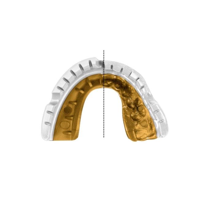 Opro Gold_Braces_Wh/Gold