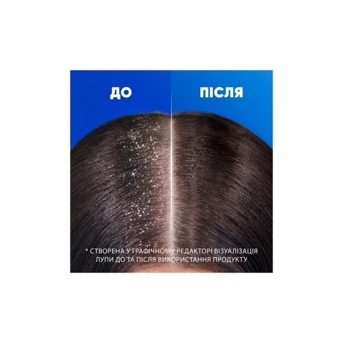Head & Shoulders 8700216157872