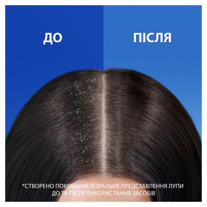 Head & Shoulders 8700216304825